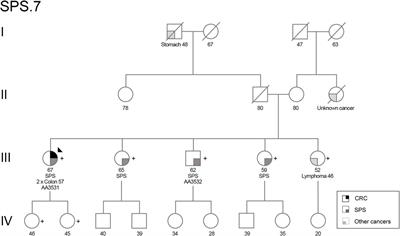 Unraveling the impact of a germline heterozygous POLD1 frameshift variant in serrated polyposis syndrome